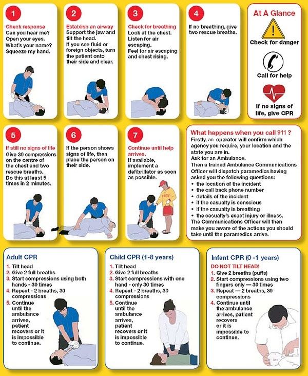 CPR Response Checklist